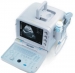 BEU-8500 Ultrasound Scanners 　　 - Result of fetal doppler