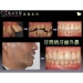 New Dental Implants - Result of Natural Stone Mosaic Tile
