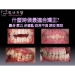 Children Dental Treatment - Result of dental