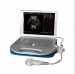 Ultrasound scanner BEU-8360A - Result of Barcode Scanner