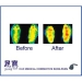 Medical Insoles Arch Support - Result of Infrared Mattress