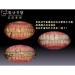 Invisible Teeth Straightening - Result of dental