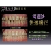 Dental Cosmetics - Result of dental